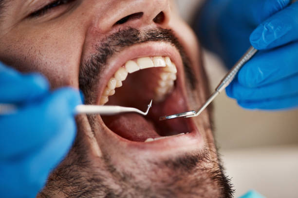 Best Emergency Dentist for Lost Fillings or Crowns in Claymont, DE